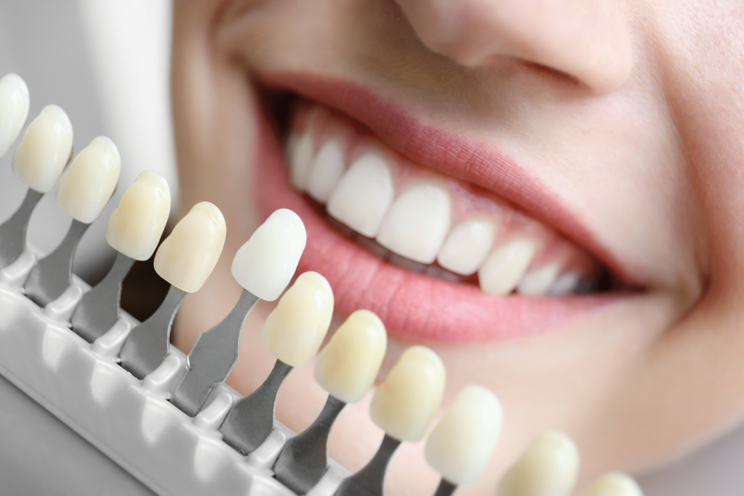 Dental Stock Photo 9 scaled